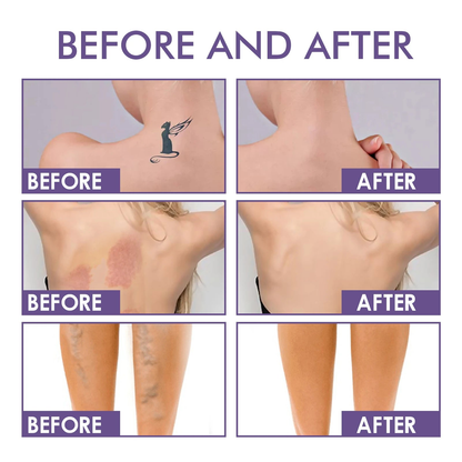 Aurelle Body Perfector